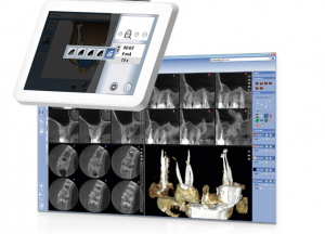 Planmeca 3D CT Scan